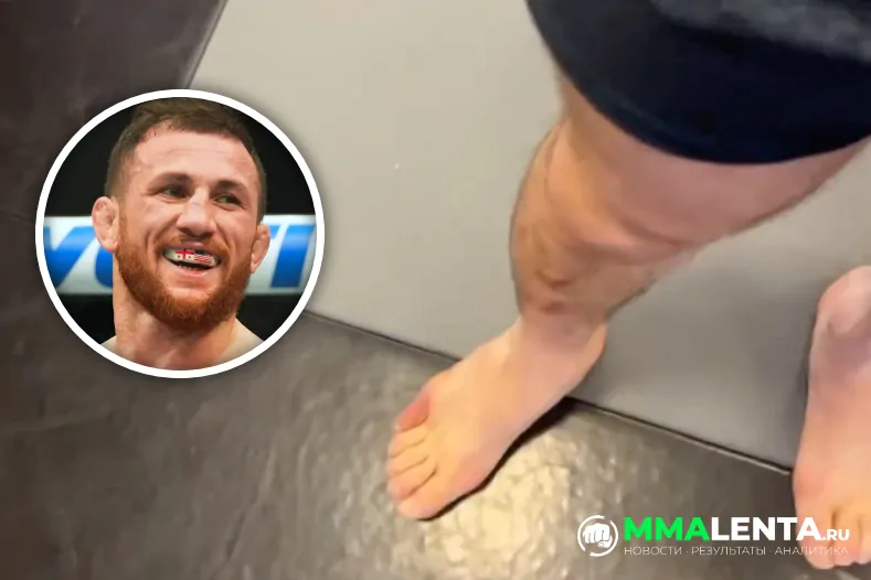 Мераб Двалишвили сломал палец на ноге за две недели до UFC 316, но не переживает: «Я его отрежу!»