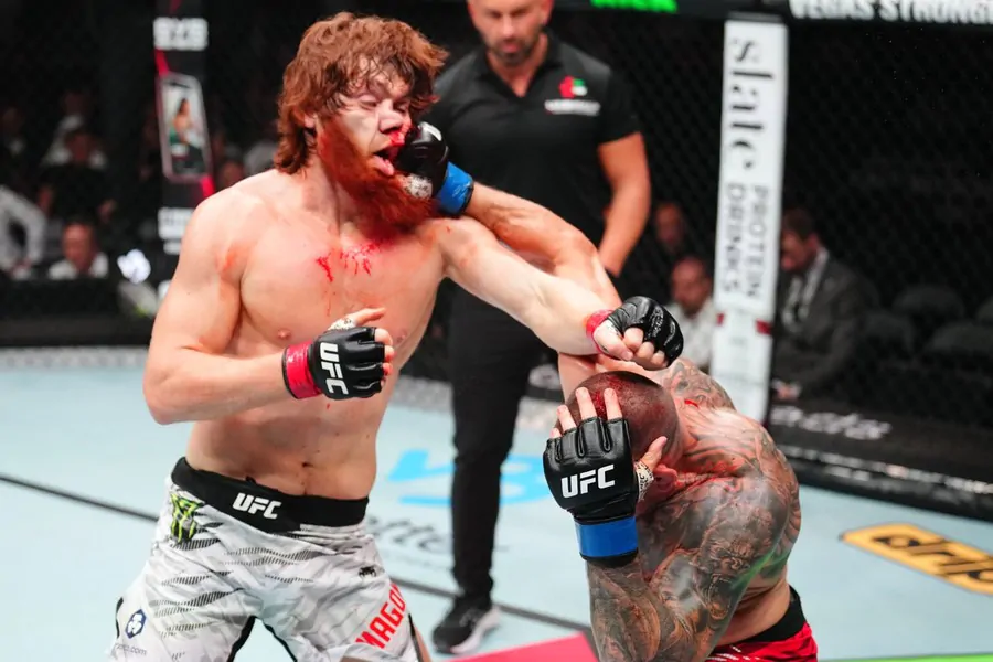 Шара Магомедов перенёс операцию на нос сразу после победы на UFC Abu Dhabi